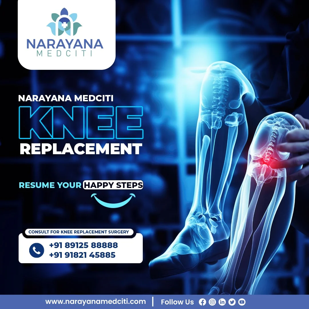 Facebook Marketing suryapet